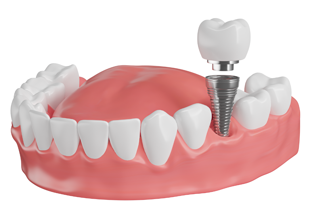 Avatar Tiktok Visana 2