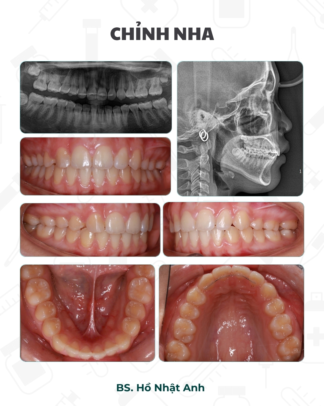 Case 2610 Fanpage BS. HO NHAT ANH